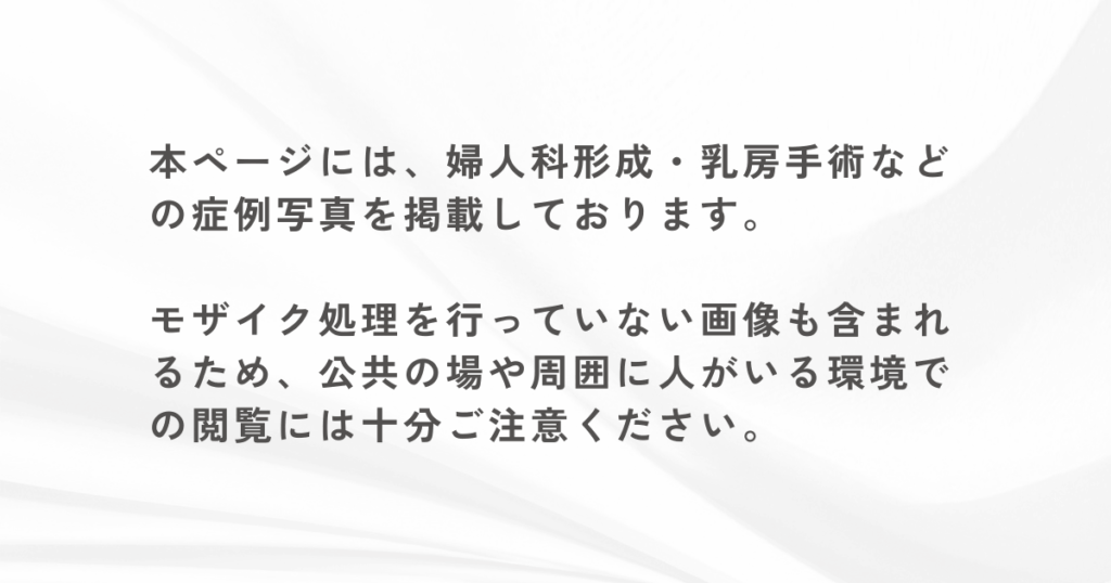 乳頭縮小＋ハイブリット豊胸